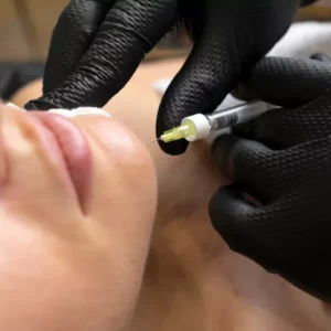 Chin Fillers