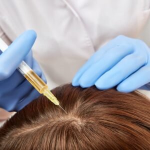 PRP HAIR REVITALIZATION
