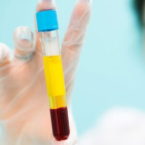 PRP Consumables