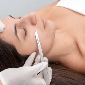 DERMAPLANING